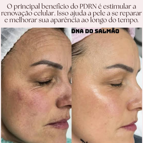 Sérum PDRN Regenerador com Tecnologia Coreana de DNA de Salmão