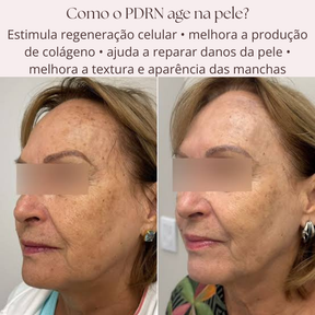 Sérum PDRN Regenerador com Tecnologia Coreana de DNA de Salmão