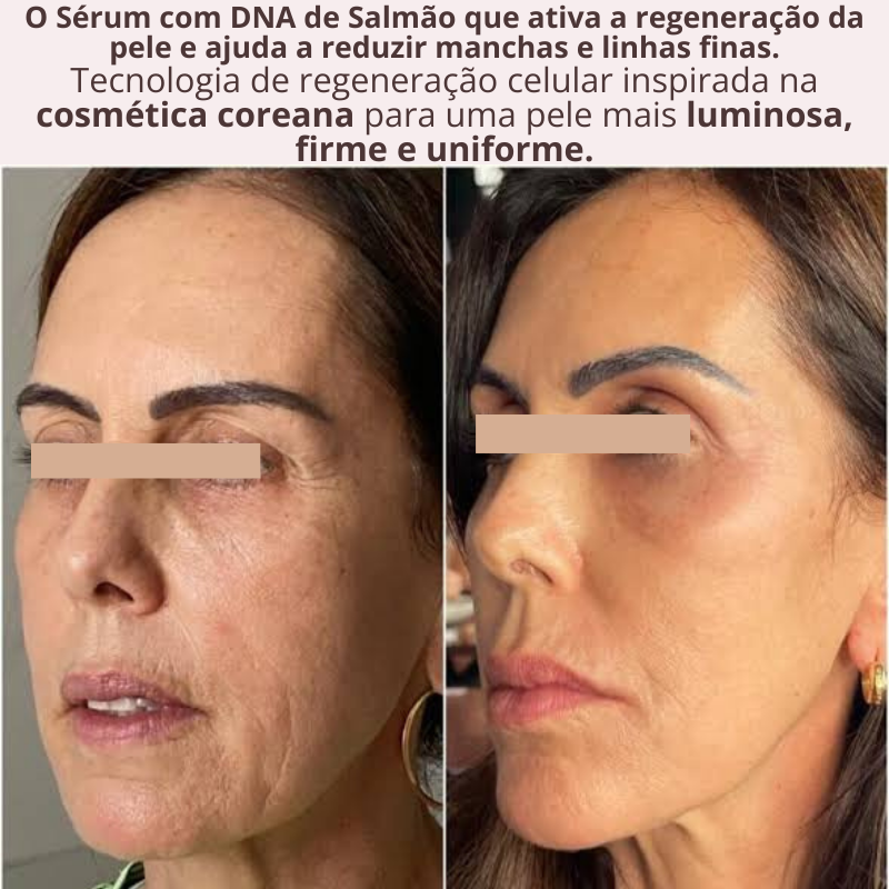 Sérum PDRN Regenerador com Tecnologia Coreana de DNA de Salmão