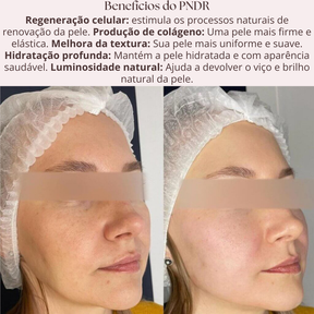 Sérum PDRN Regenerador com Tecnologia Coreana de DNA de Salmão
