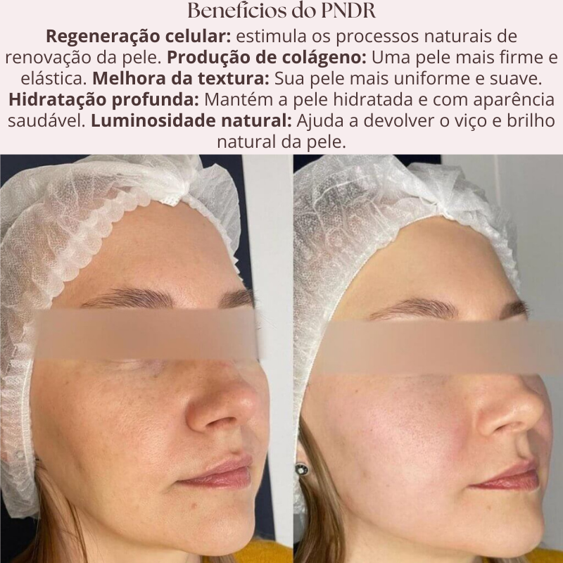 Sérum PDRN Regenerador com Tecnologia Coreana de DNA de Salmão