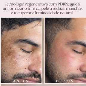 Sérum PDRN Regenerador com Tecnologia Coreana de DNA de Salmão